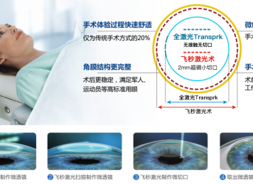 蔡司全飞秒&Smart全激光