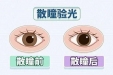 散瞳——近视防控中不可或缺的一环